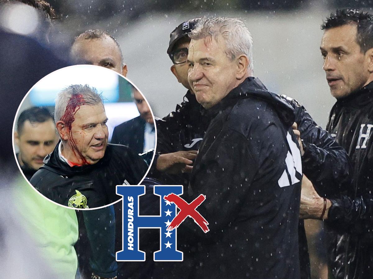 Honduras y el duro castigo que estaría recibiendo por FIFA luego del juego ante México donde hirieron al Vasco Aguirre