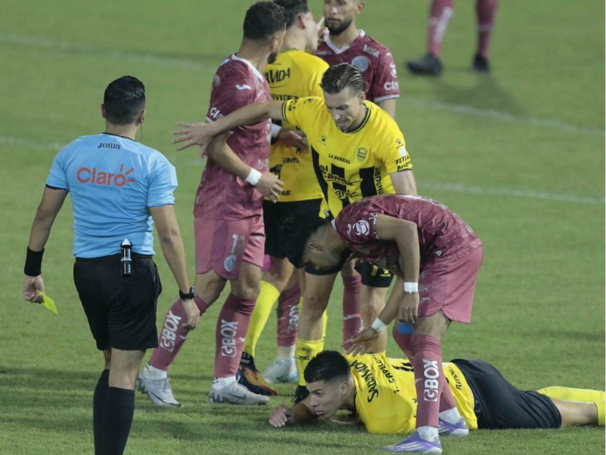 Zafarrancho entre Real España-Motagua, chica del ciclón enamora, argentino sorprende y el frío se apoderó en el Morazán