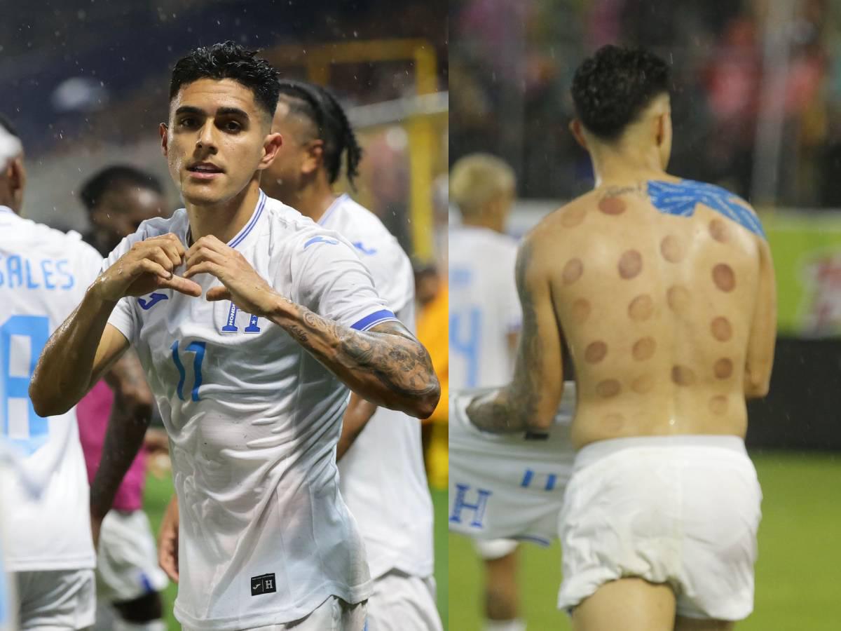 Luis Palma y su noche mágica contra la Selección Mexicana, la marca que impuso con Honduras ¿Por qué tiene moretones en su espalda?