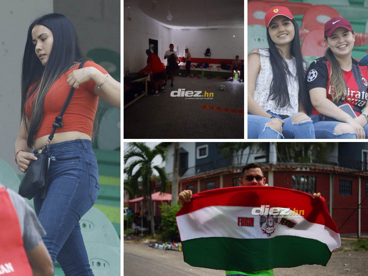 Las bellas aficionadas del Marathón, el Yankel Rosenthal sin “luz” y la espantosa lesión de Clayvin Zúniga