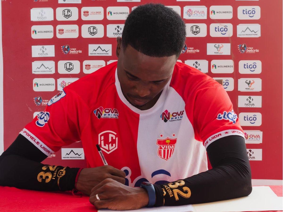 Exjugador de Olimpia revela el viacrucis que vivió por dos años tras sufrir terrible lesión: esta es su realidad