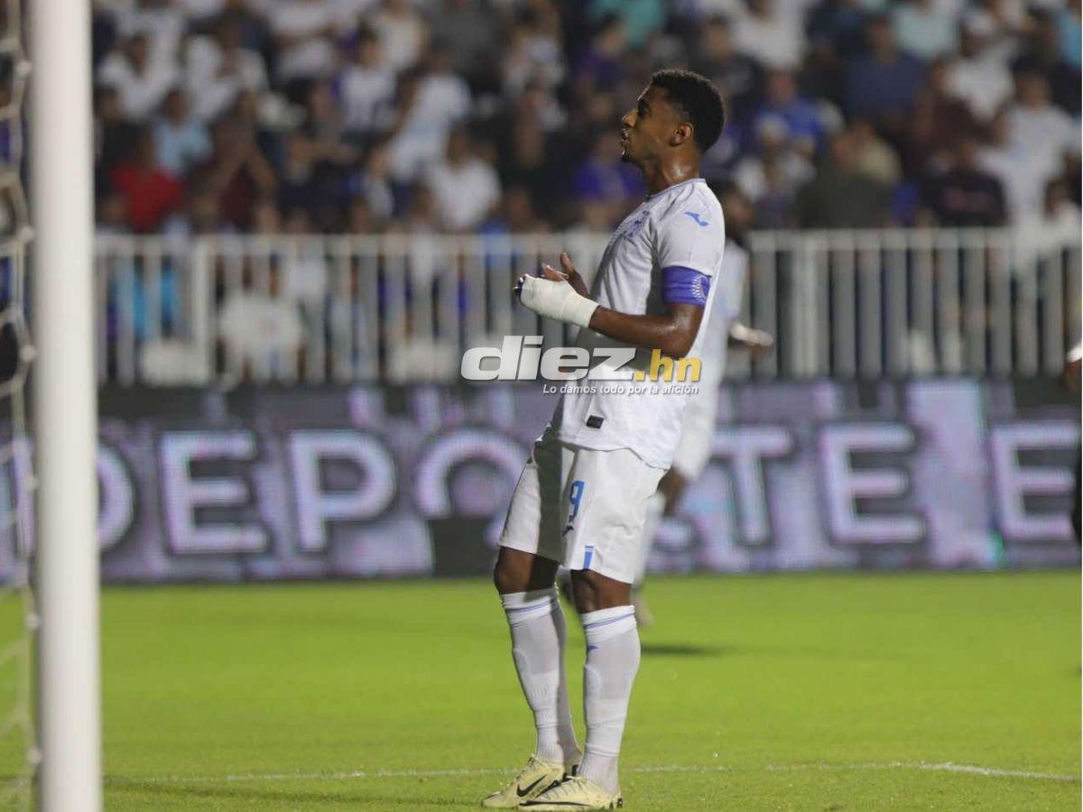 No se vio en TV: los rostros de la frustración de la Selección de Honduras tras perder ante Jamaica por Nations League