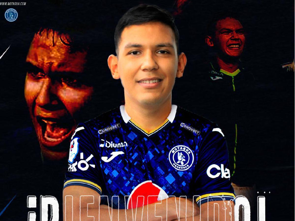 ”Pistolero”, “Pibe”, “El Chelito”: Estos son los apodos más famosos en la Liga Nacional, ¿por qué les dicen así?