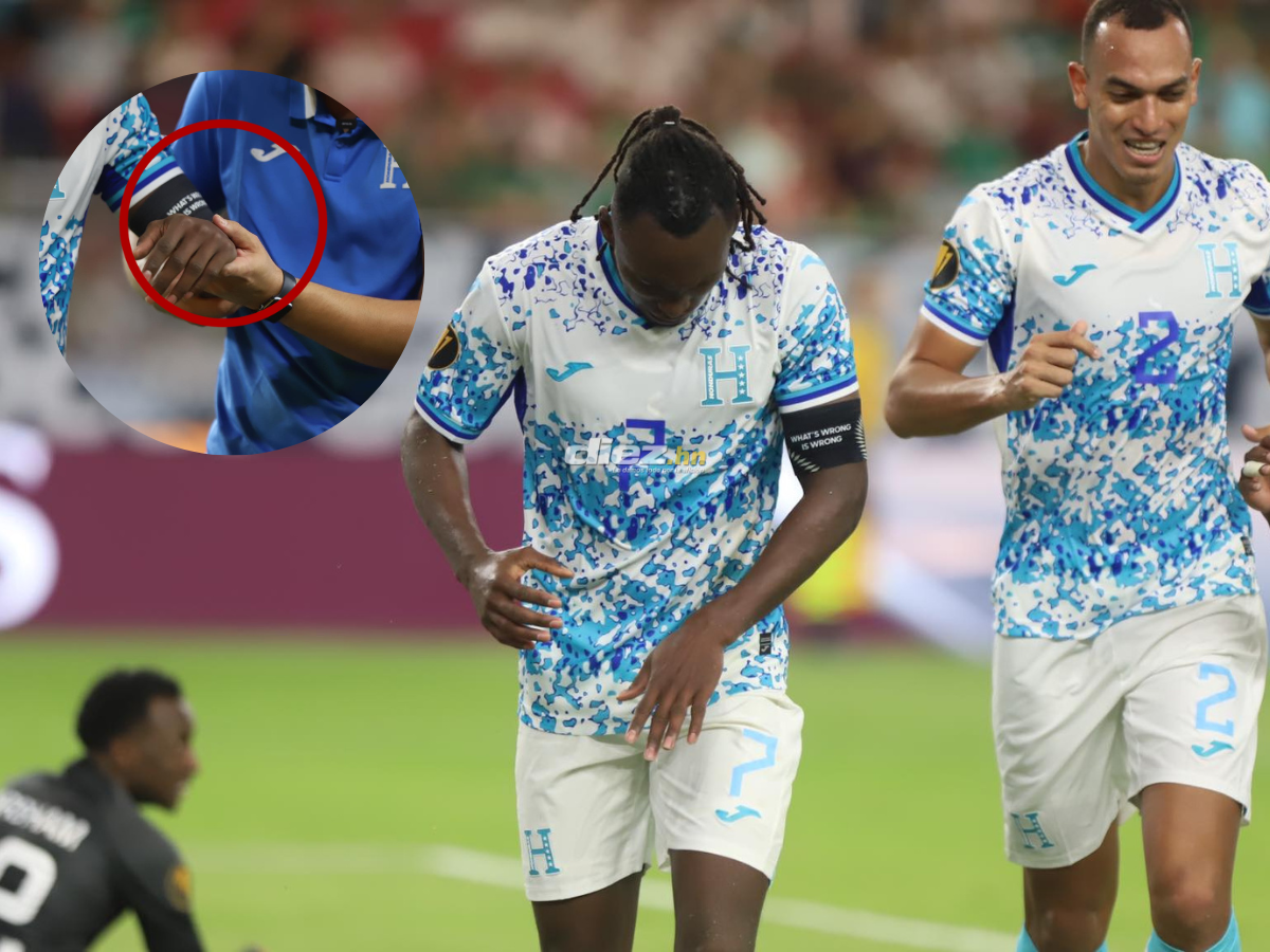 Confirmado: Alberth Elis se fracturó el brazo izquierdo y se pierde el resto de la Copa Oro 2023 con Honduras