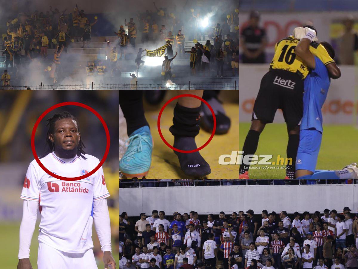 ¿Qué pasó con Falero en conferencia? Tristeza de Olimpia, Real España armó la fiesta y la dolorosa lesión de Jhow Benavídez