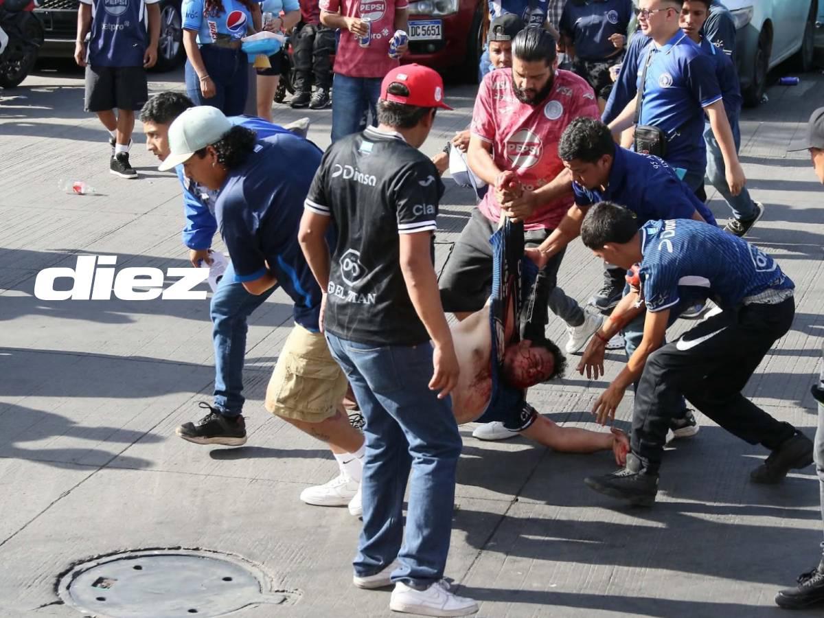 Herido trasladado por aficionados de Motagua.