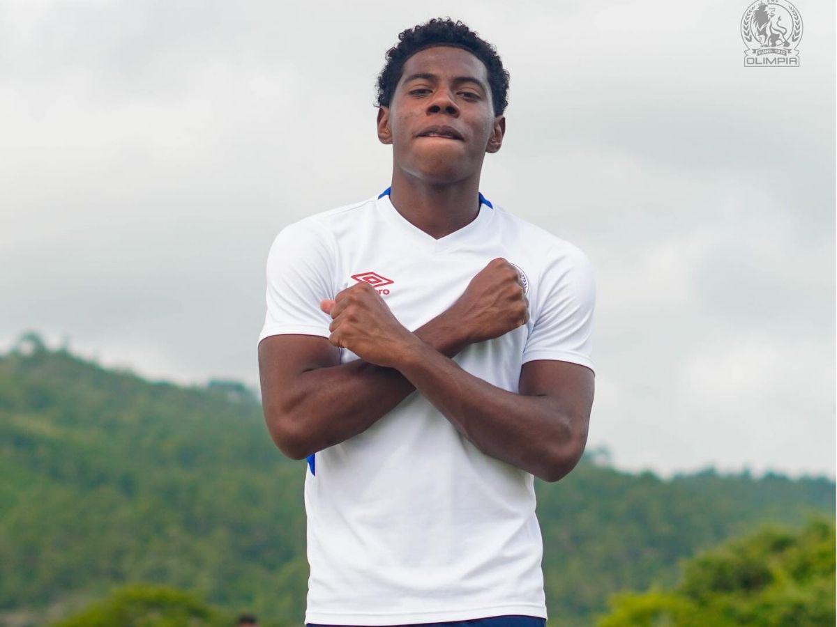 ¡Volvió Edwin Rodríguez! Olimpia y el eléctrico 11 titular que se perfila para golpear al Cartaginés por Concacaf