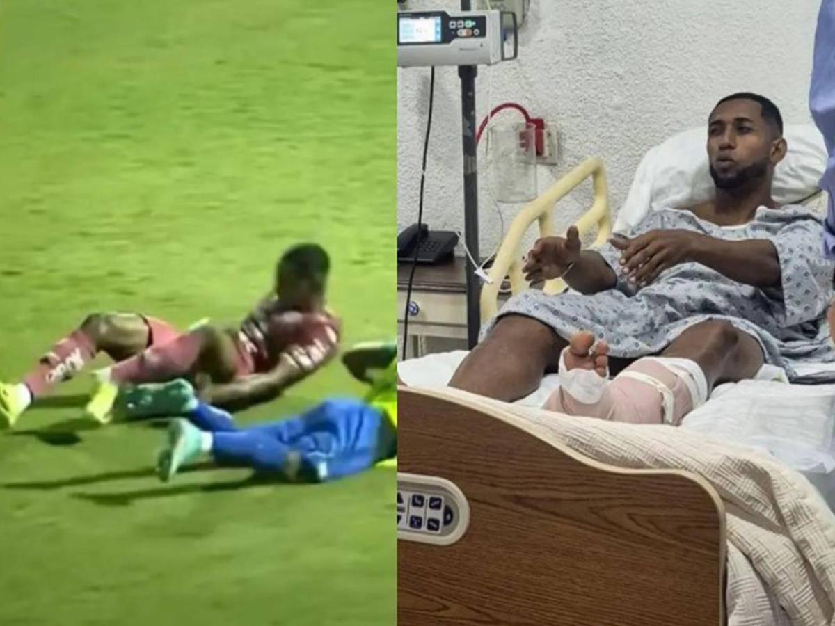 Romario se suma: sufrieron las lesiones más escalofriantes en el fútbol