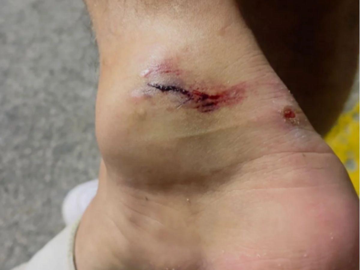 Lobos explota ante el arbitraje por brutal falta contra Marcos Morales frente a Real España: El fútbol exige justicia