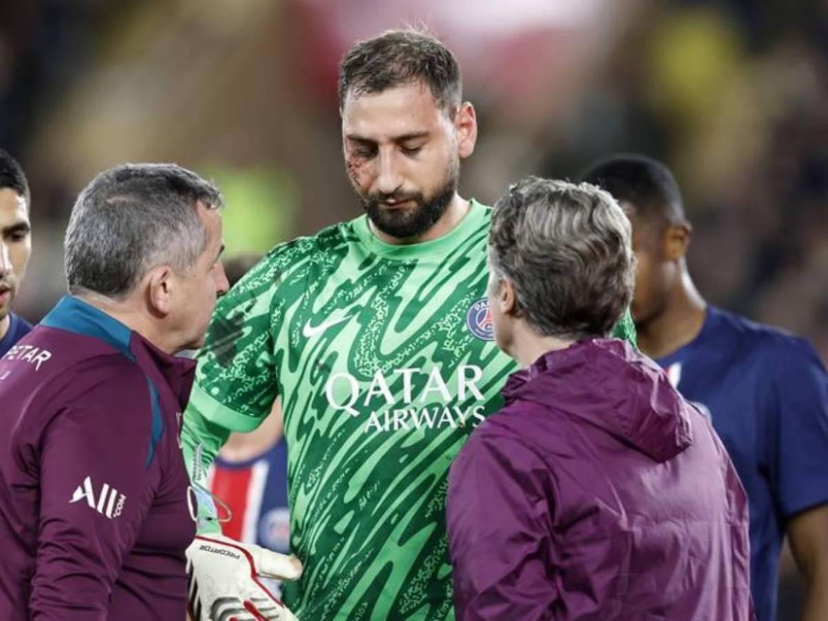 La impactante lesión de Donnaruma que recibió una patada en el rostro y tuvo que ser reemplazado ante Mónaco