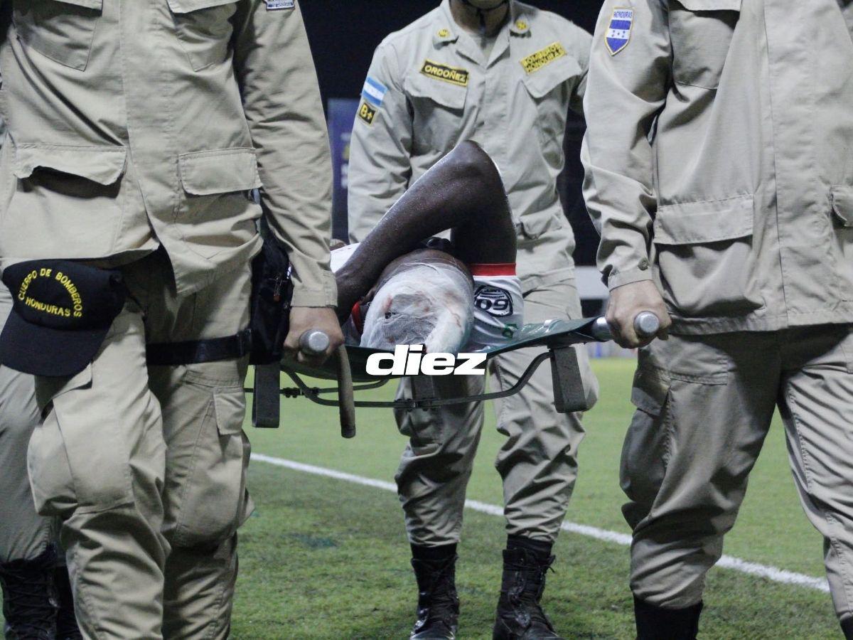 Brutal golpe de futbolista de Real Sociedad, bronca en Real España, las chicas que enamoraron y el fotón a la luna