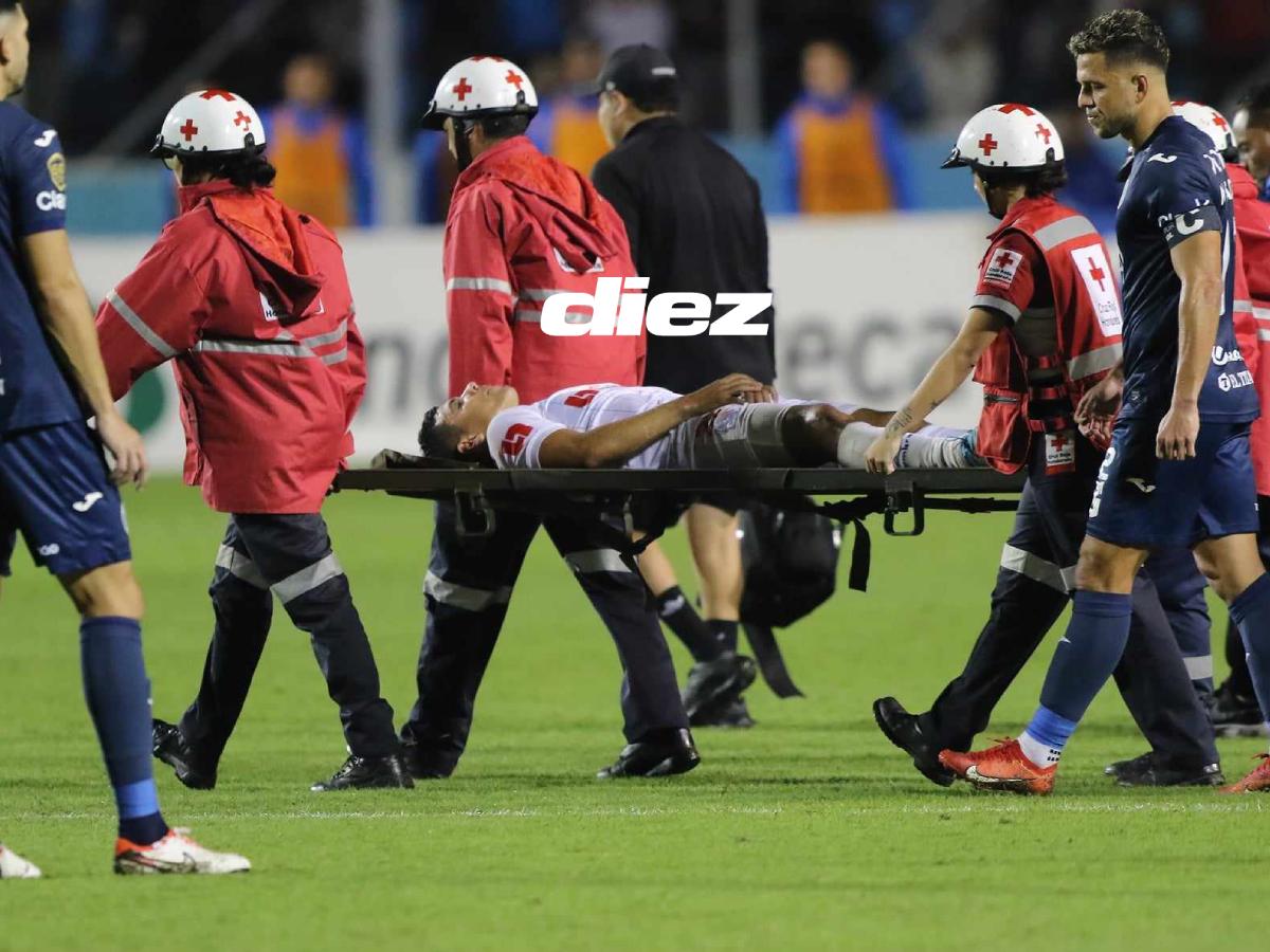 No se vio en TV del Motagua-Olimpia: Bronca entre jugadores, polémica en la final y las novias de los Auzmendi en el Nacional