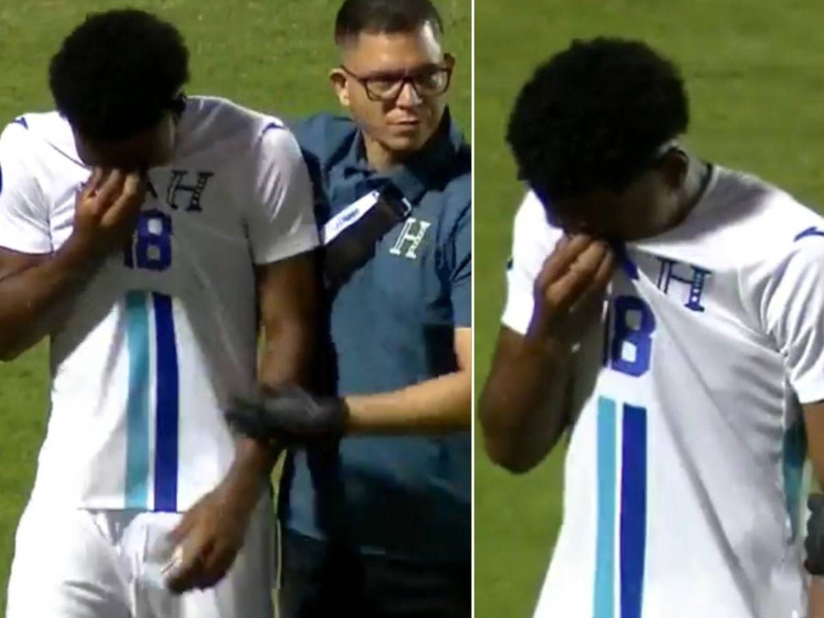 Lágrimas de Dereck, tristeza de Keyrol y leyenda vio a Honduras caer ante Surinam