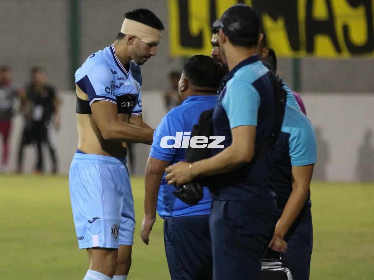 La noche de Rodrigo Auzmendi, el gol al estilo de Lamine Yamal y fiesta de Motagua tras humillar al Génesis en la liguilla