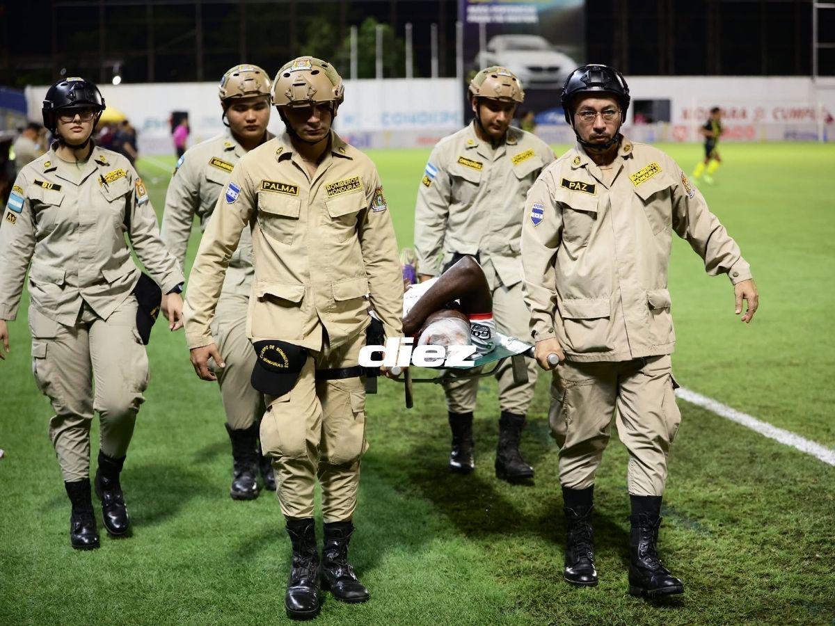 Brutal golpe de futbolista de Real Sociedad, bronca en Real España, las chicas que enamoraron y el fotón a la luna