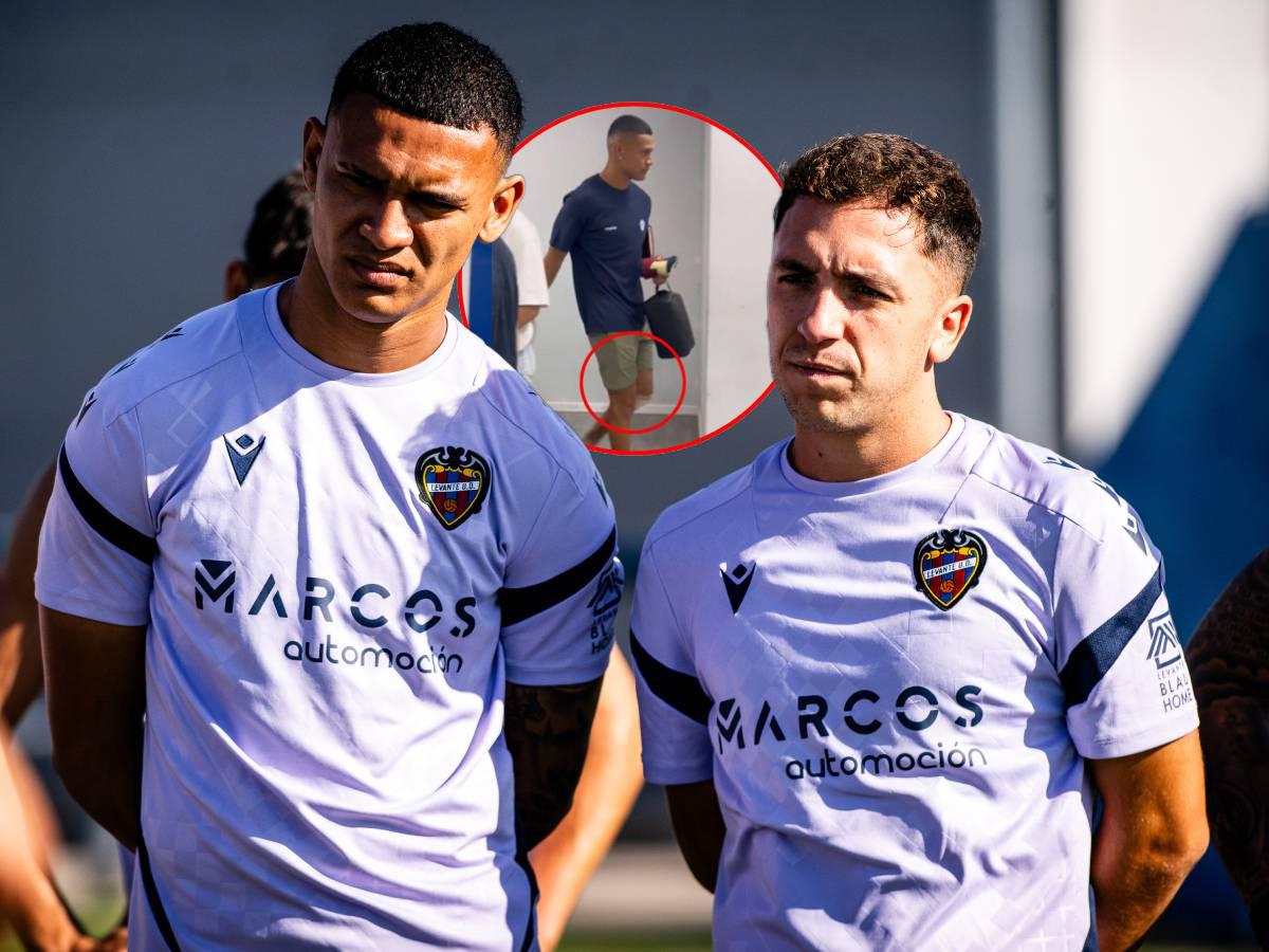 Rueda ya lo sabe: este es el informe médico de Kervin Arriaga tras salir cojeando luego del jugar ante Real Madrid