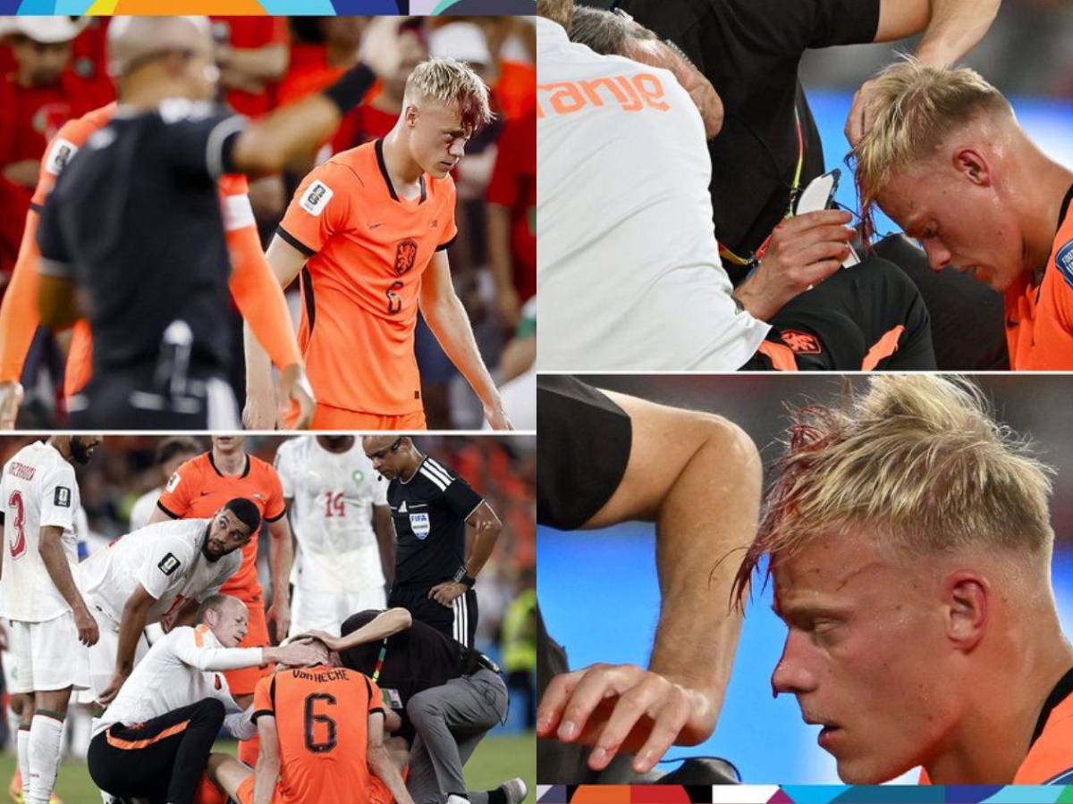 Tapada de Bono recorre el mundo, por qué lloró Gakpo y jugadores se abren la cabeza