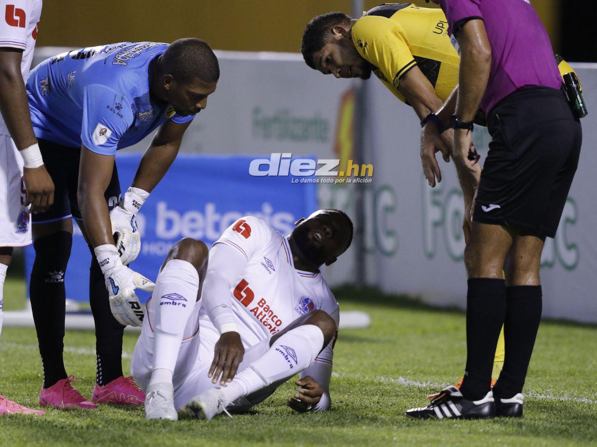 No se vio en TV: Show de “Buba” López contra Olimpia, las bellas chicas del clásico, bronca del DT de Real España y la policía blindó el Olímpico