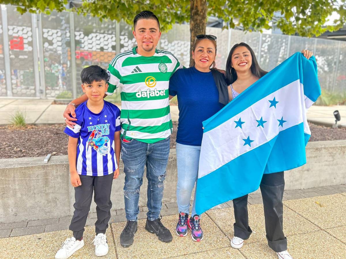 Luis Palma es sorprendido por hondureños en el duelo entre Celtic vs DC United en Estados Unidos