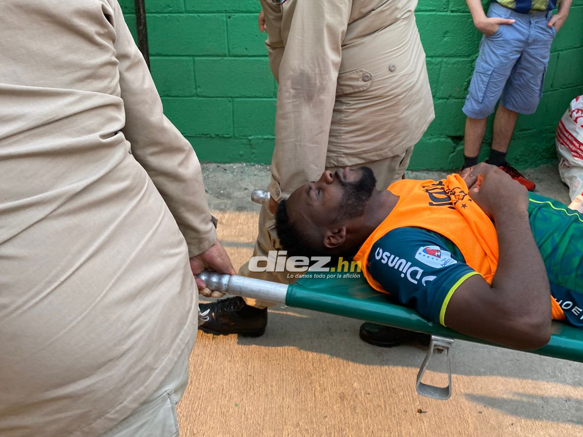 Las bellas aficionadas del Marathón, el Yankel Rosenthal sin “luz” y la espantosa lesión de Clayvin Zúniga