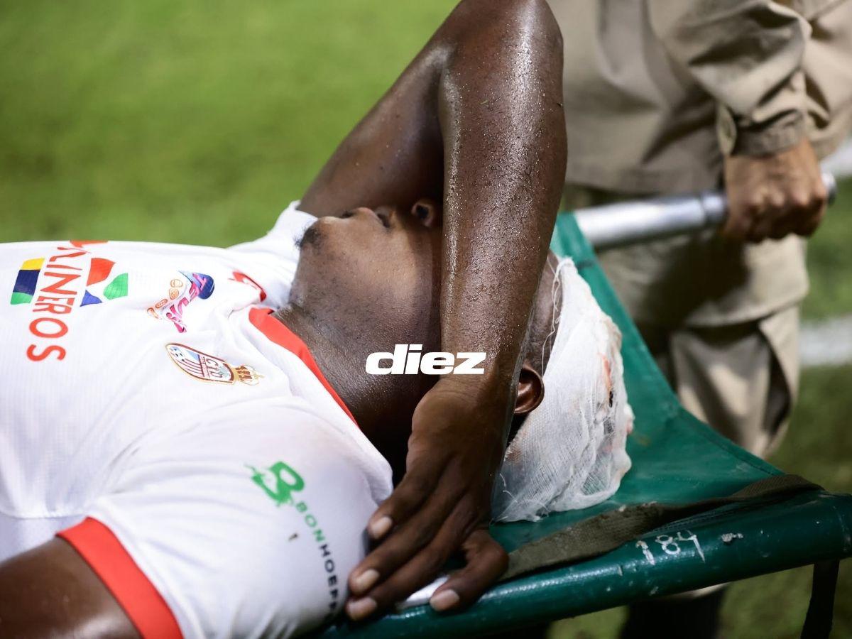 Brutal golpe de futbolista de Real Sociedad, bronca en Real España, las chicas que enamoraron y el fotón a la luna