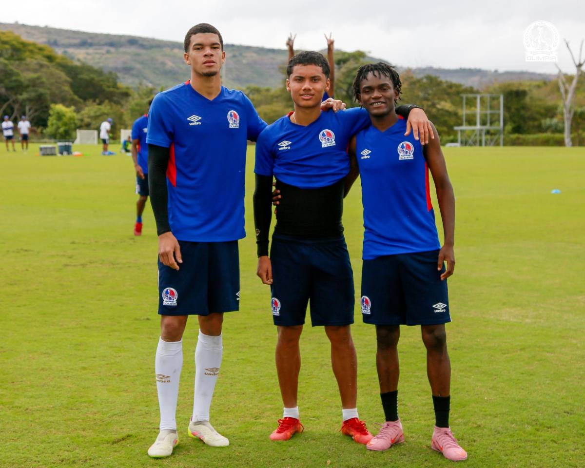 Alerta en Olimpia: futbolista sufre dura fractura y otro un desgarro que podría perderse el duelo ante el América