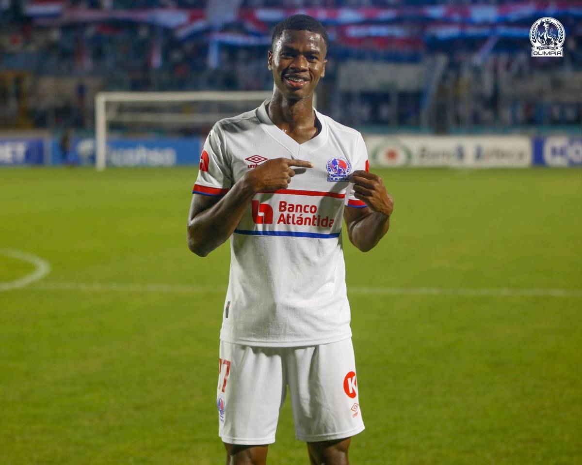 ¡Pensando en América! Olimpia y los cambios que prepara hoy de su alineación titular para su juego de la jornada 4