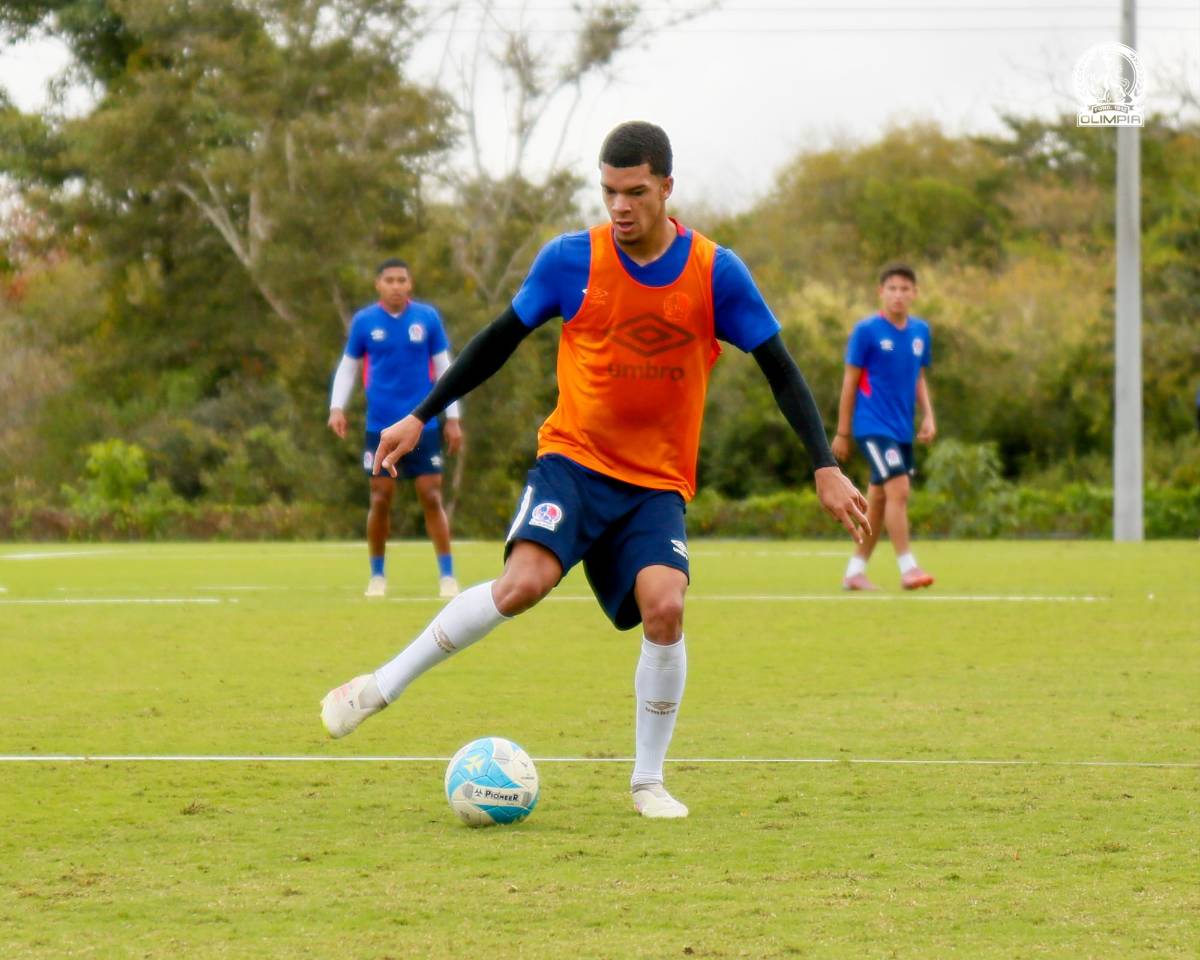 Alerta en Olimpia: futbolista sufre dura fractura y otro un desgarro que podría perderse el duelo ante el América
