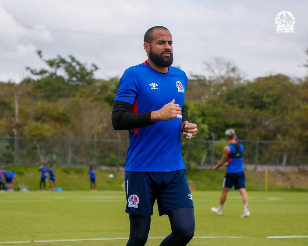 Alerta en Olimpia: futbolista sufre dura fractura y otro un desgarro que podría perderse el duelo ante el América