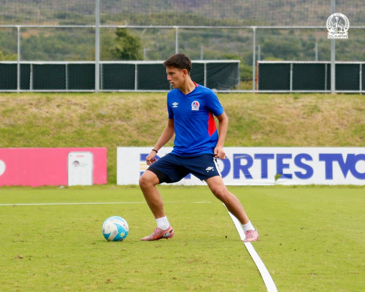 Alerta en Olimpia: futbolista sufre dura fractura y otro un desgarro que podría perderse el duelo ante el América