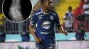 Romario Da Silva aún no ha sido operado ya que le tienen que limpiar el hueso.
