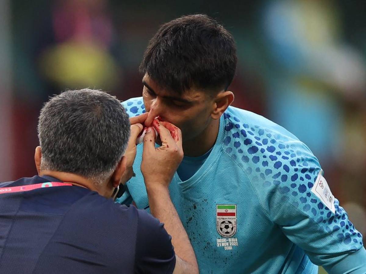 FOTOS: Portero de Irán se fue en camilla luego de recibir terrible golpe de su propio compañero en el Mundial de Qatar 2022
