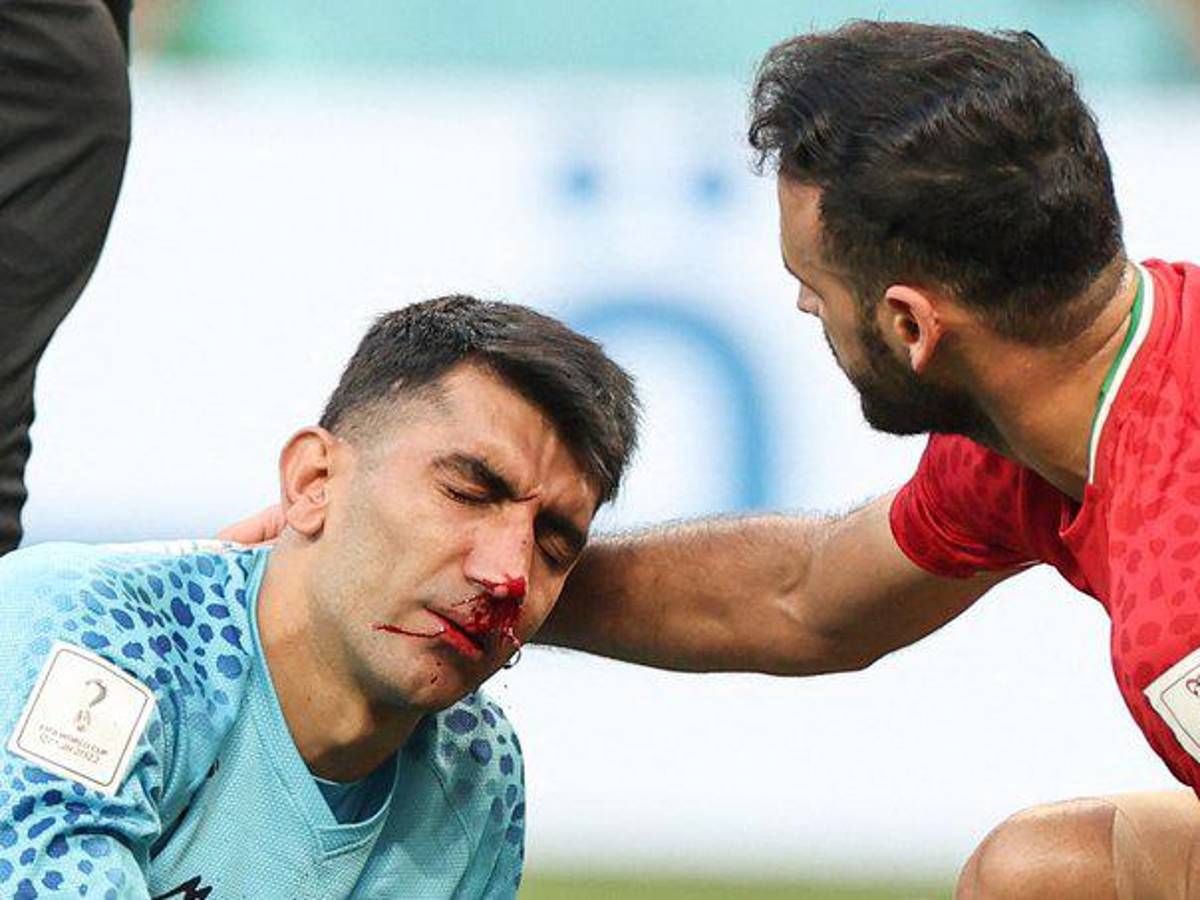 FOTOS: Portero de Irán se fue en camilla luego de recibir terrible golpe de su propio compañero en el Mundial de Qatar 2022