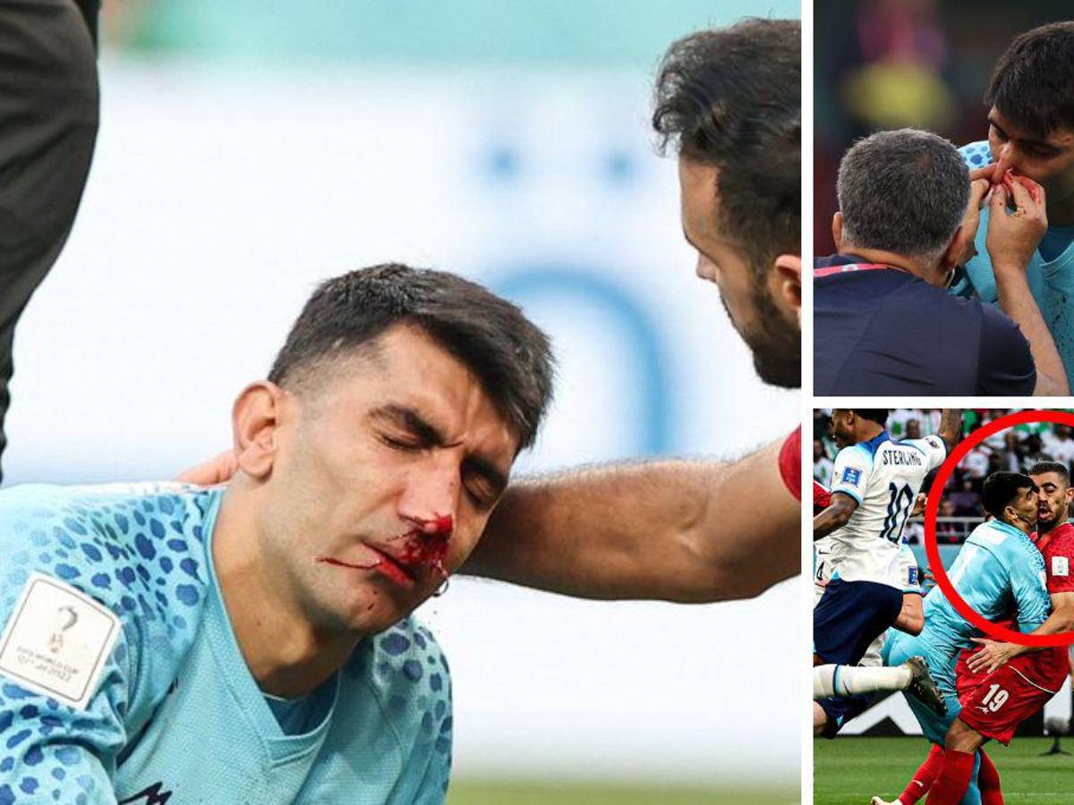FOTOS: Portero de Irán se fue en camilla luego de recibir terrible golpe de su propio compañero en el Mundial de Qatar 2022