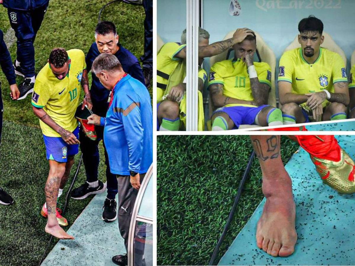 ¡Neymar lesionado! Qué tiene, cuánto tiempo estará de baja y qué partidos se perdería con Brasil en el Mundial Qatar 2022
