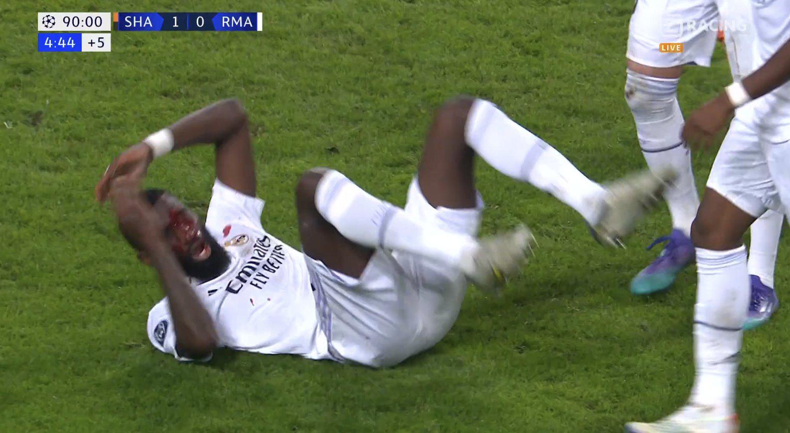 Rudiger recibió un fuerte golpe del arquero tras marcar el empate del Real Madrid.