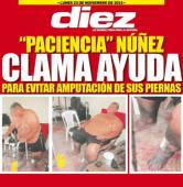 El técnico Rafael 'Paciencia' Núñez necesita que se le tienda una mano para evitar que le amputen sus piernas.