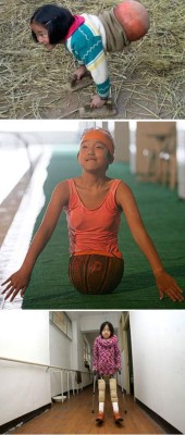 REPORTAJE: La increíble historia de una niña china, sin piernas y campeona de natación