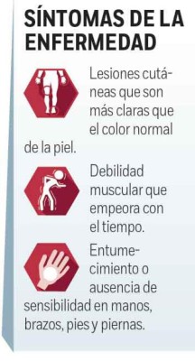 Alerta en México tras reportarse 89 casos de lepra, algo que pone en vigilancia al sector salud