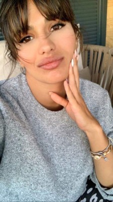 '¿Qué te ha pasado?' Mujer de crack del Real Madrid es atacada por su impactante aumento de labios&nbsp;&nbsp;