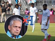 Epidemia de lesiones en Honduras: ¡Se confirma la baja de otro legionario para los partidos ante Bermudas!