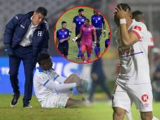 El fútbol hondureño va tumbo tras tumbo: La Sub 17 fue apaleada por Brasil, pero hay otros fracasos que vienen desde muy atrás