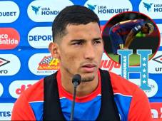 José Mario Pinto confesó en conferencia de prensa que sufre la misma lesión que Lamine Yamal, futbolista de Barcelona.