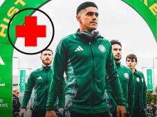 El ariete hondureño no apareció en la convocatoria en el triunfo del Celtic contra el Hibernian.