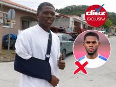 Jaylor Fernández se fracturó la clavícula y eso le hace perderse el resto de torneo.