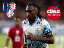 Exclusiva: Alberth Elis, tras ser sometido a un coma inducido, alienta a Honduras desde su cama en Francia: “Voy a volver pronto”