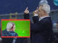 Vasco Aguirre provocó con gestos obscenos antes de sufrir duro golpe en su cabeza tras el triunfo de Honduras ante México