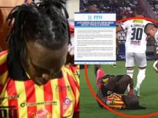 Rubilio Castillo no se pudo controlar y lloró durante el encuentro de la primera división de Colombia.