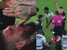 Doloroso momento para Sergio Ramos al ver su rostro con sangre y Choco Lozano fue expulsado.