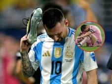 Messi podría ser baja con la Selección de Argentina ante Brasil y Uruguay.